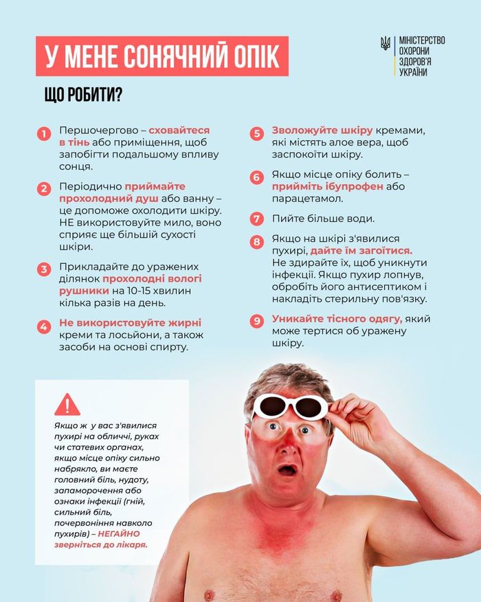 рекомендації МОЗ при сонячних опіках